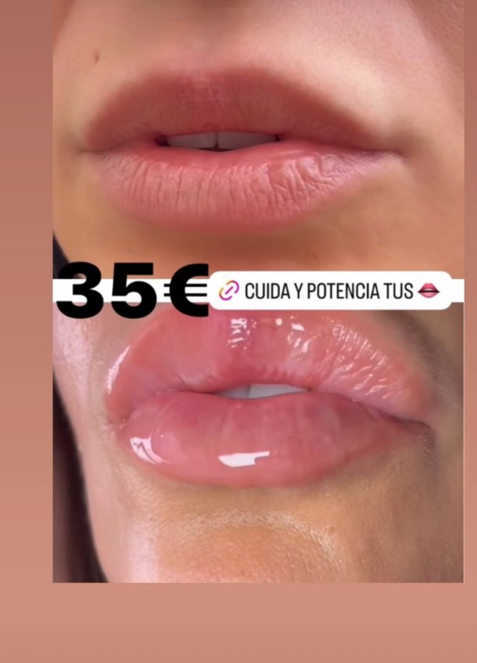 lorenalorenae76's tweet photo. Resultados del bálsamo reparador y volumizador, edición limitada para Navidad. https://t.co/WoW9VSxcnP