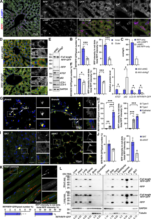 JCellBiol's tweet photo. Spatial assessment of ER-phagy activity and ER architecture in different tissues. From Sang, Li, Sun et al describing new reporter mouse models that enable flexible and diverse in vivo assessments of ER-phagy and ER architecture  https://t.co/yyDgLXmPvo

#ER_literature #Autophagy https://t.co/jtDF8xmY1B