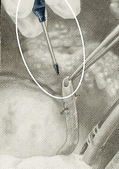 Voss Medical Products tweet media