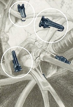 Voss Medical Products tweet media