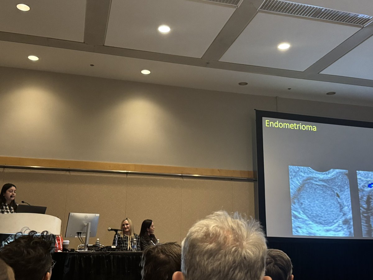 saraaahzzz's tweet image. Such an amazing session presented by @WendalineVB @PriyankaJhaMD ,and @lucianachamiec1 on the crucial concepts in endometriosis imaging. Packed with insightful knowledge and innovative techniques😍😍
#RSNA24 #endometriosis