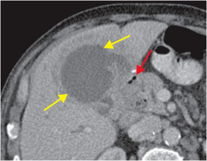 Poor communication is a significant cause of medical error

In 2022-3 it was commonest cause of never events such as wrong site surgery,  implants or protheses, and retained instruments/swabs

Our latest case of the month highlights poor communication 

coress.org.uk/case-of-the-mo…