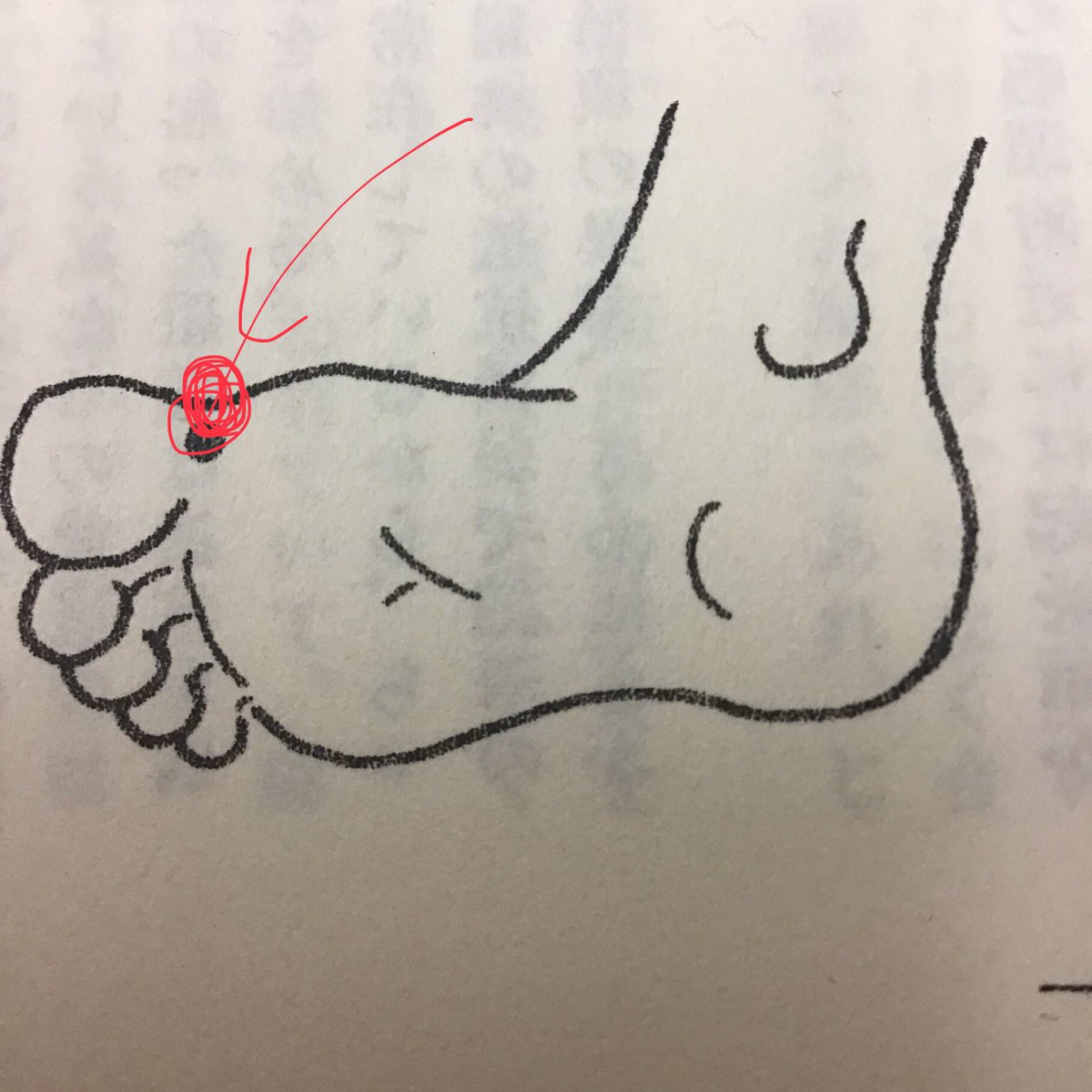 dCNZ85zXLoaQNkR's tweet photo. 鍼灸師の私にとって「風邪かな？」と喉の異和を感じた時

それは「待ってました！」の好機到来🤣最速で最大の効果を発揮し、この症状を頓挫させるには、を試す絶好のチャンス！

そうして自己実験を繰り返し「のどけの灸」を自家薬籠中の物にした。灸医が正式に認められ、例えば発熱外来で、もしも↓ https://t.co/HfwKSon5F5