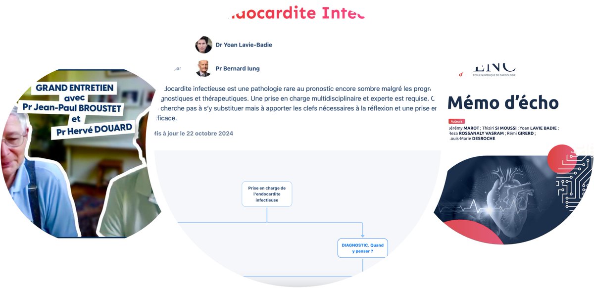 EcoleNumCardio's tweet photo. 📢 Les incontournables de novembre à l'ENC :

👑 Protocole star : Endocardite infectieuse
📽️ Vidéo top : Grand Entretien avec Pr Broustet &amp; Pr Douard 
🛠️ Mémo d’écho, toujours incontournable 

📩 Inscrivez-vous à notre newsletter (48h avant envoi !) 👉 https://t.co/VuylsjKMmy https://t.co/NkmE1yM8YS