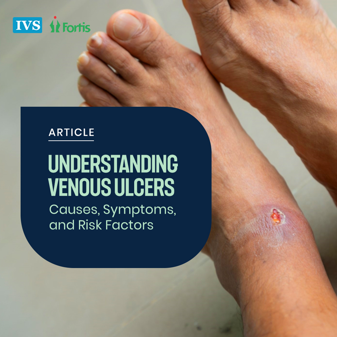 callidora_laser's tweet image. Venous ulcers are painful wounds caused by poor blood circulation. Learn about their causes, symptoms, and risk factors. Read our full blog for more information.
bit.ly/3AUOLog
#Venousulcers #poorbloodcirculation #Venousulcerssymptoms #Venousulcerscauses