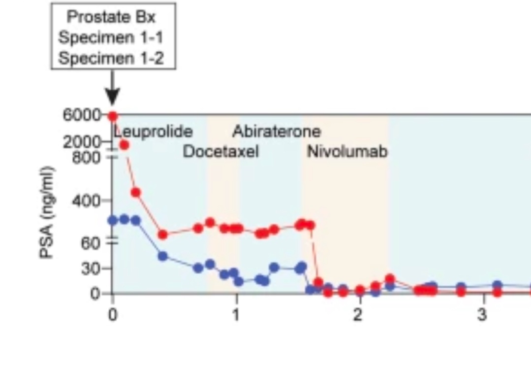EAntonarakis's tweet image. Fascinating case report by @laurasenamd on a PCa patient with heterogeneous prostatic lesions, one with MMR deficiency and the other with BRCA2 loss, both of which led to metastatic outgrowths at different time points and selection pressures.