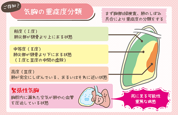 #気胸 が疑われる際は #胸部X線検査 を行います。 肺のしぼみ具合で重症度の分類が可能です📝 <分類>軽度、中等度、高度、緊急性気胸 場合に ...