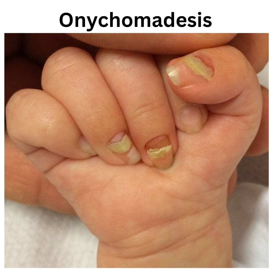 HealthThenMore tweet media