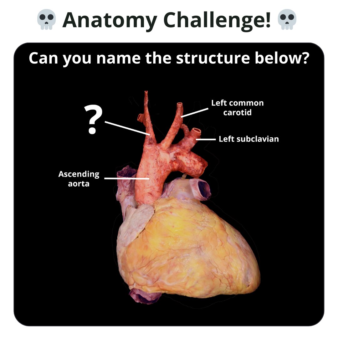 TeachMe_Support's tweet image. Anatomy challenge of the week 🏆 Can you name the structure?  #quizyourself #meded #medschool #medicalstudent #premed #premedlife #nursing #nursingschool #pastudent #physician #futuredoctor #studymotivation #medlife #medschoolmemes #medicalmeme  #medstudentlife  #geekymedics