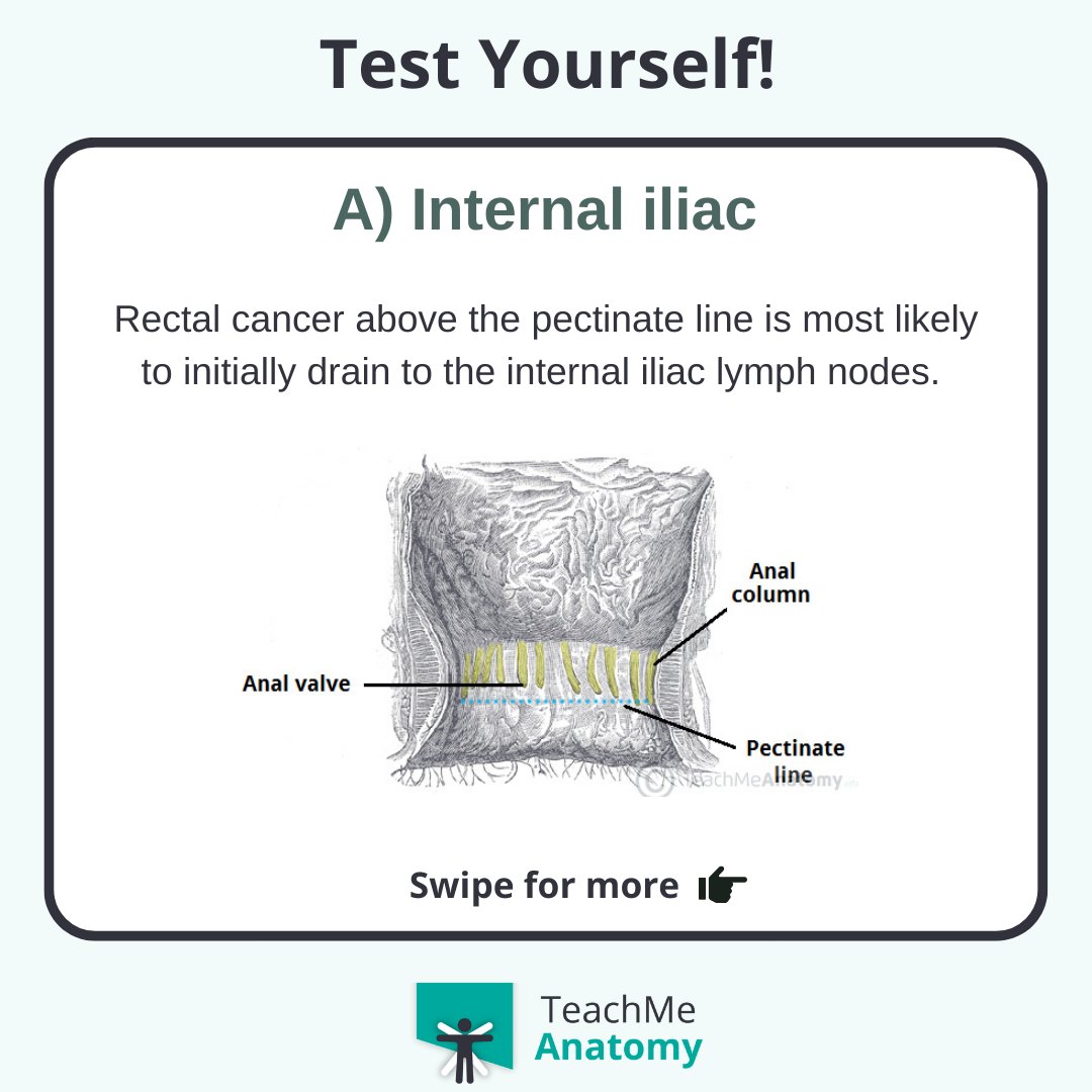 TeachMe_Support's tweet image. Test yourself 🏆 Which initial group of lymph nodes will the cancer most likely spread to? #quiztime #QuizoftheWeek#meded #medschool #medicalstudent #medstudent #premed  #nursing #nursingschool #pastudent #physician #futuredoctor #premed #studymotivation #medlife #surgery