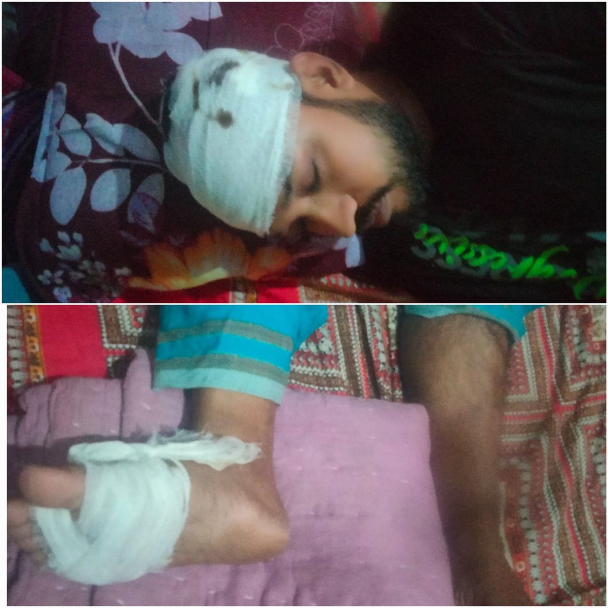 bdwatch2024's tweet photo. Why didn't any lawyer turn up to represent #ChinmoyKrishnaDas in #Chattogram today? Because of the climate of intimidation and fear the Interim Govt, #BNP, and #JamaatEIslami have deliberately created among the lawyers, esp. #Hindu ones. Here's what has happened so far:

Chinmoy's bail hearing was not held today (Dec 3), as scheduled earlier, as no defence lawyers were present in court at 11 am. The next hearing has been set for a month later on January 2 by Chattogram Metropolitan Sessions Judge Mohammad Saiful Islam.

Why wasn't Chinmoy Das legally represented today? First, 70 lawyers, mostly belonging to the #Hindu community, have been falsely implicated in a violence case surrounding the events of Nov 26 and they are now in hiding. 

News🔽

https://t.co/xm58RCwc8h  

Secondly, Chinmoy's lawyers have been physically attacked too. Advocate Regan Acharjee was violently attacked, allegedly by #Jamaat-aligned lawyers of CTG Sessions Court on Nov 26. As @hrcbm reports, shockingly, he has even been obstructed from accessing proper medical treatment at recognized hospitals, and his whereabouts remain unknown.

See: https://t.co/G4EkDRnjcY

#HRCBM further reports that Advocate Ramen Roy, a respected High Court practitioner, was brutally attacked with machetes during a peaceful protest at #Shahbagh, #Dhaka, against the unfair arrest of Chinmoy. Allegedly, this attack was carried out by cadres of BNP and Islamists. Adv. Roy sustained severe injuries, including the loss of part of his skull, and remains in the ICU fighting for his life.

See: https://t.co/fpZRDVVhh2

Thirdly, as if the attacks and false cases were not sign enough to stay clear, #BNP-#Jamaat aligned lawyers today openly threatened anyone against representing Chinmoy in court. They are clearly warning that any lawyer who dares to file even an affidavit for Chinmoy would be subjected to "mob beating" in Chattogram Court premises (watch video). 

Even two assistants who went to jail to give Chinmoy his medicines and religiously prepared food have been arrested. News🔽

https://t.co/XP0DudRKly

This makes the very motivation of the Interim Govt to go after a monk that much clearer. The merits of the #sedition charge were dubious to begin with. But these balatant and violent means of keeping an accused unrepresented legally is further proof that the intention is to make Chinmoy unavailable and unfree as long as possible. 

Chinmoy is paying the price for speaking out against minority repression in Bangladesh under Dr. #Yunus' Regime. 

He should be: 

1. Released on bail immediately; 
2. Allowed proper access to legal representation;
3. Allowed visitation rights;
4. Allowed an impartial and fair trial. 

The world must keep the pressure up on the Interim Govt to abide by Bangladesh's constitutional and international human rights obligations. 

...............

#SaveBangladeshiHindus
#AllEyesOnBangladeshiHindus 
#BangladeshiHindus
#HindusUnderAttackInBangladesh 
#hindusarenotsafeinbangaladesh
@austhindu @avroneel80 @GBHAlliance @hindupost @HinduVoice_in @k36077 @SBHPage @CoHNAOfficial @HinduAmerican @INSIGHTUK2 @HinduAmerican @HFAFPAC @UtsavSanduja @CJBdingo25 @Chellaney @CoHNAOfficial
