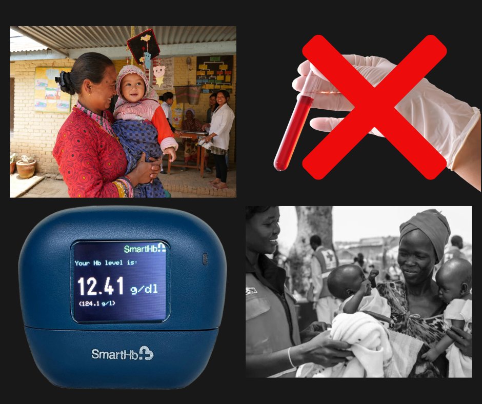 Tech4Life1's tweet image. Tech4Life’s Smart-Hb empowers individuals, healthcare providers, and health systems to tackle anemia more effectively. 

Read the complete blog:
lnkd.in/dPSZhExa

hashtag#InnovationInHealthcare hashtag#SmartHb hashtag#NonInvasiveMonitoring hashtag#AnemiaAwareness