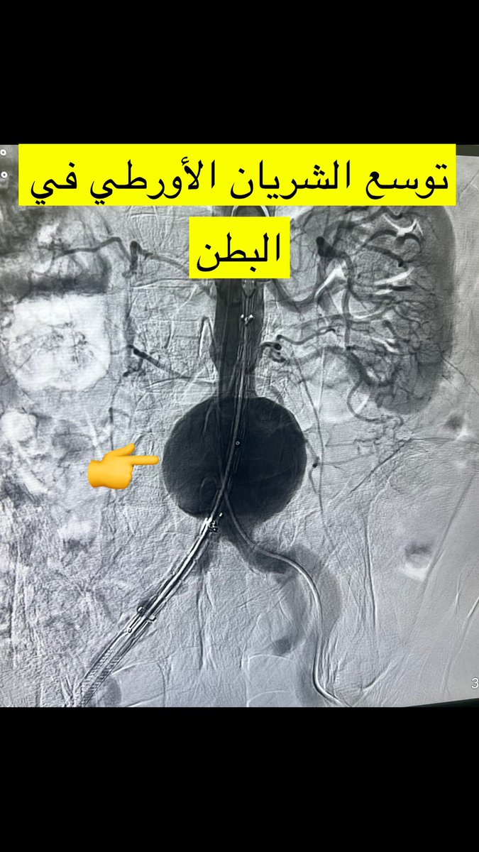 الدكتور محمد آل مطلق. Dr.Mohammed Almutlaq tweet media