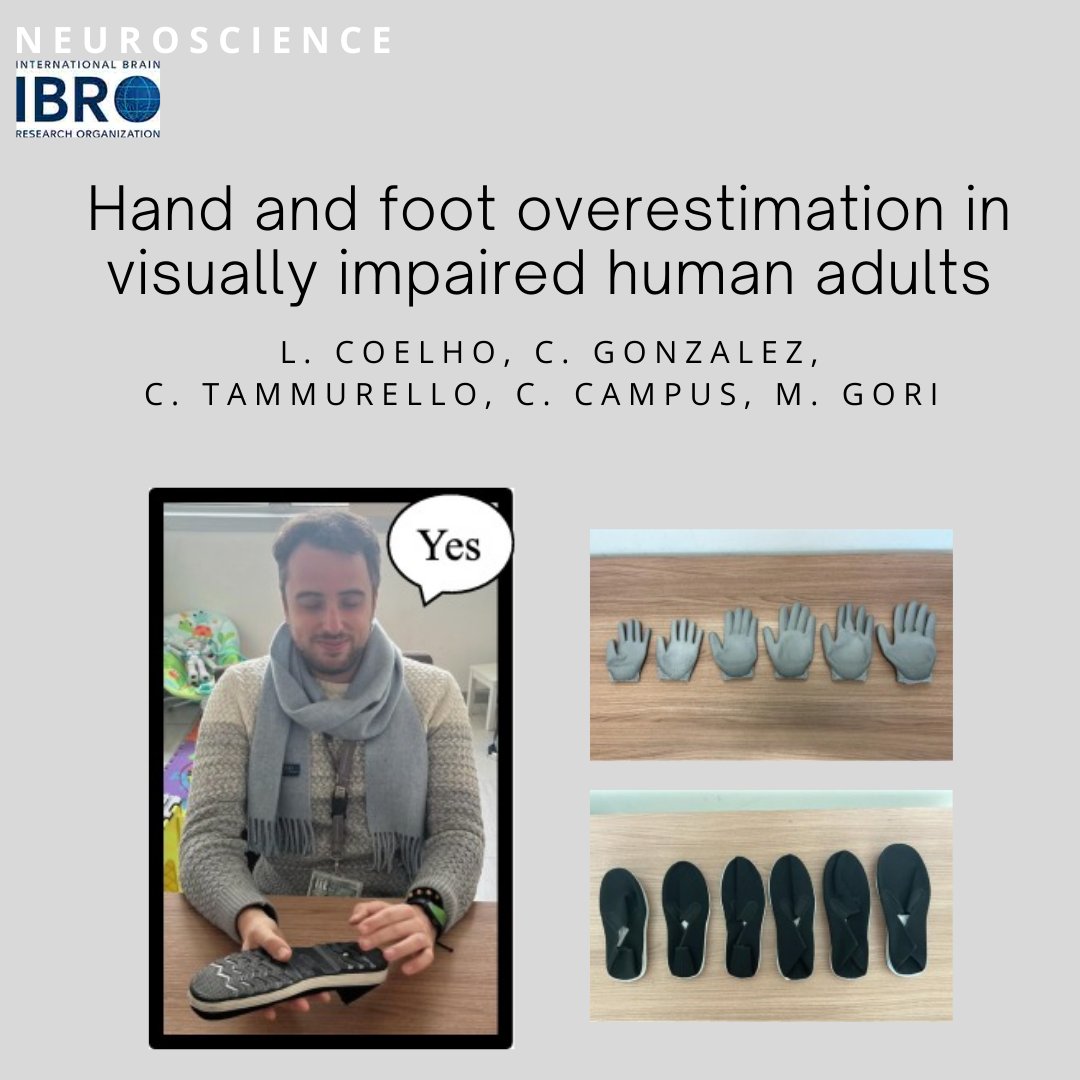 🚨 New Research Alert 🚨
Our latest study, is now published! The results show differences in the overestimate of hand and foot size in sighted and #blind adults, as well as #sex differences. 👉 sciencedirect.com/science/articl…
<a href="/IITalk/">IIT</a>