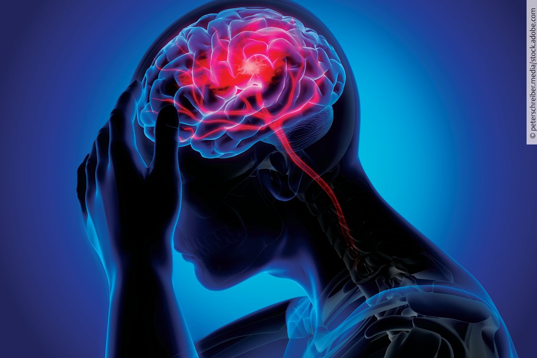 🌍 Call for Papers: Endovascular! We’re seeking innovative research on endovascular approaches in neurosurgery for our GRAND SPECIAL ISSUE. Submit your work to WFNS Journal today: lp.thieme.de/journals/wfns-… 
#Neurosurgery #Endovascular #WFNSJournal #Thieme