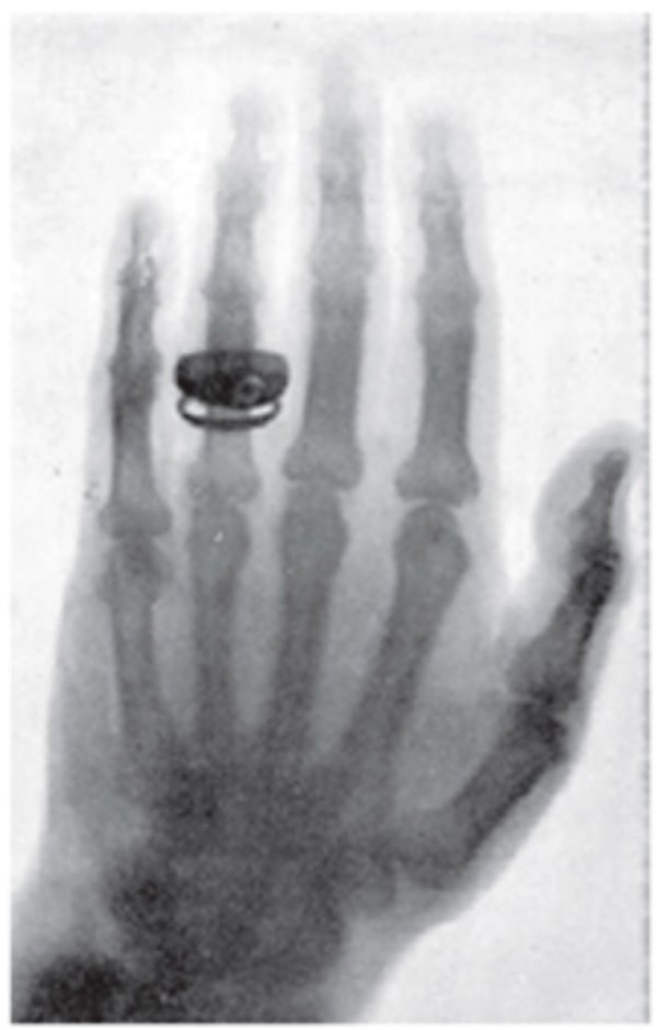qubsmdpi2023's tweet image. 🩻This paper by Suprakash C. Roy explores the history and development of X-ray research in India, particularly during the colonial period and its foundational role in shaping modern X-ray research in the country.
🔎Read the full paper at: mdpi.com/2412-382X/6/2/…
#X_ray #history