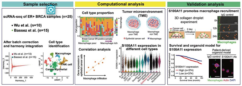 Yannis Zervantonakis (@zervanto) on Twitter photo Our paper “Cancer-cell derived S100A11 promotes macrophage recruitment in ER+ breast cancer” published in
OncoImmunology <a href="/tandfonline/">Taylor & Francis Research Insights</a>, bit.ly/mfs100a11 collab. w/ H. Osmanbeyoglu, <a href="/oesterreichs/">Dr. Steffi Oesterreich</a> and <a href="/Adrianvlee/">Adrian Lee</a>, S. Lee & Y. Cho, support by
<a href="/UPMCHillmanCC/">UPMC Hillman Cancer Center</a> <a href="/PittBioE/">Pitt Bioengineering</a>
<a href="/UPMCnews/">UPMC</a> Our paper “Cancer-cell derived S100A11 promotes macrophage recruitment in ER+ breast cancer” published in
OncoImmunology <a href="/tandfonline/">Taylor & Francis Research Insights</a>, bit.ly/mfs100a11 collab. w/ H. Osmanbeyoglu, <a href="/oesterreichs/">Dr. Steffi Oesterreich</a> and <a href="/Adrianvlee/">Adrian Lee</a>, S. Lee & Y. Cho, support by
<a href="/UPMCHillmanCC/">UPMC Hillman Cancer Center</a> <a href="/PittBioE/">Pitt Bioengineering</a>
<a href="/UPMCnews/">UPMC</a>