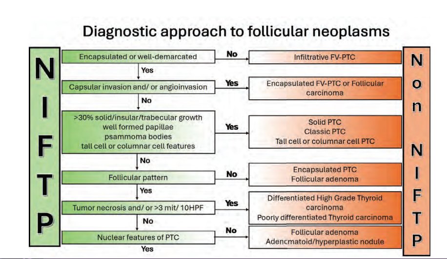 Janiranavarro's tweet image. Thyroid-Diagnostic approach to follicular neoplasms
Non-invasive follicular thyroid neoplasm with papillary-like nuclear features  (NIFTP)  vs Non NIFTP

Dr. Dioufa #CAP24 #pathology #pathologists #PathTwitter #PathX #pathresidents #pathfellow
