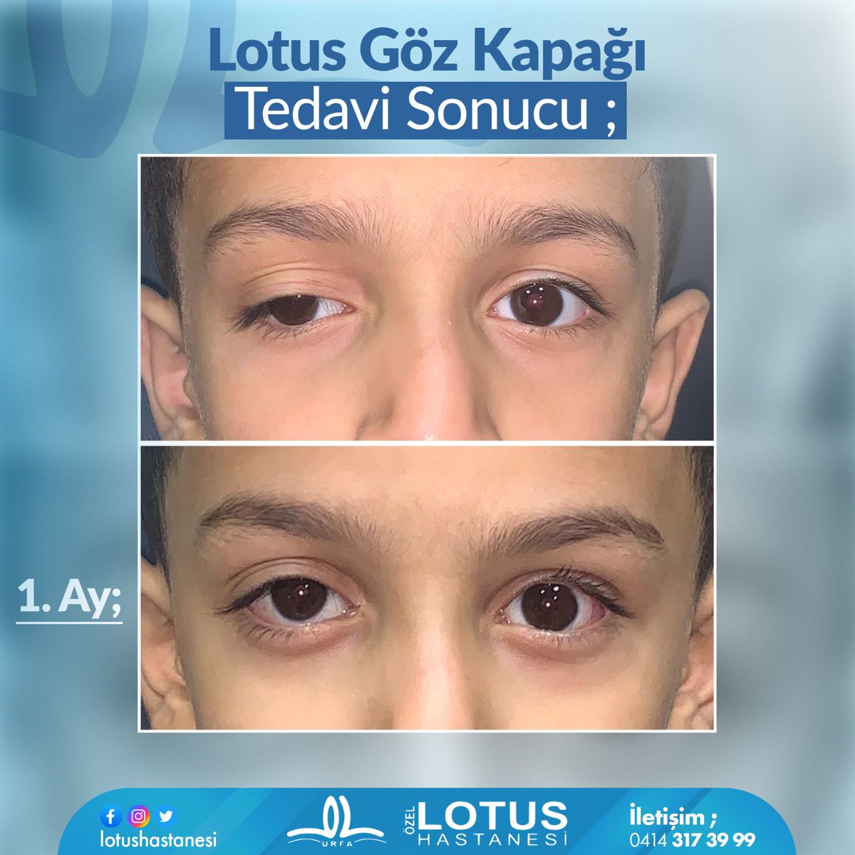 AkinCiftkus's tweet photo. @bulentazizz @lotushastanesi https://t.co/6r26dfSvzp