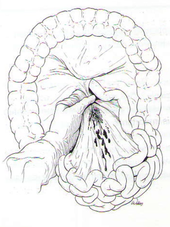 Dr Luis Felipe Cabrera Vargas MD FACS tweet media