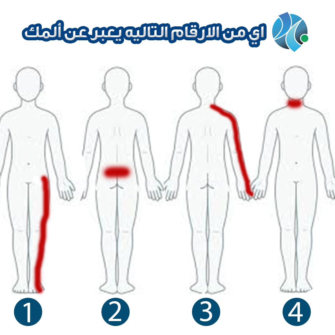 اي من الارقام التاليه يعبر عن ألمك ؟