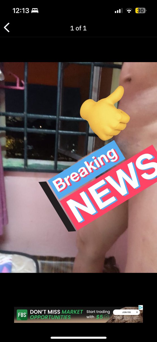 拇指指的那个是什么东西？开关吗？