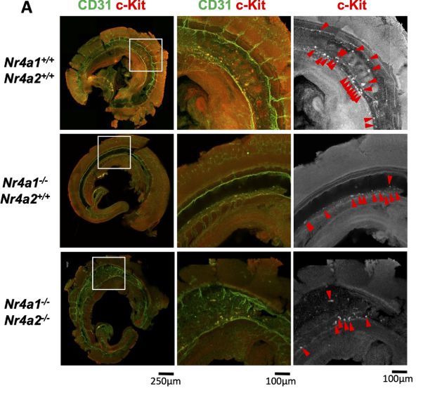 Development (@dev_journal) on Twitter photo NR4A1 and NR4A2 orphan nuclear receptors regulate endothelial-to-hematopoietic transition in mouse hematopoietic stem cell specification
Read this Stem Cells & Regeneration Research Article by @dianasbd, Shannon McKinney-Freeman, Wilson Clements, <a href="/mganuza1981/">Ganuza_Lab (@ganuzalab.bsky.social)</a>& co NR4A1 and NR4A2 orphan nuclear receptors regulate endothelial-to-hematopoietic transition in mouse hematopoietic stem cell specification
Read this Stem Cells & Regeneration Research Article by @dianasbd, Shannon McKinney-Freeman, Wilson Clements, <a href="/mganuza1981/">Ganuza_Lab (@ganuzalab.bsky.social)</a>& co
