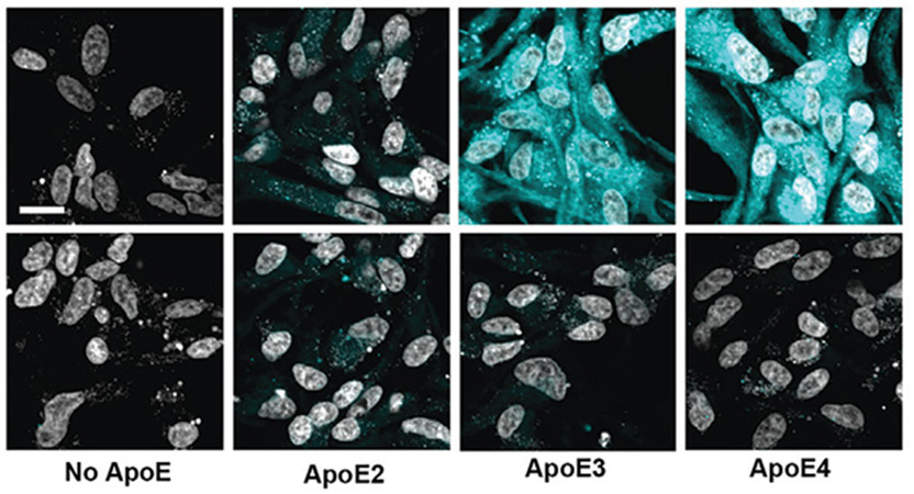 alzforum's tweet image. Scientists may have discovered why ApoE4 causes Alzheimer’s disease and ApoE2 prevents it. Hint: the reasons are different. @Denalitx ow.ly/vMyS50Ukn90