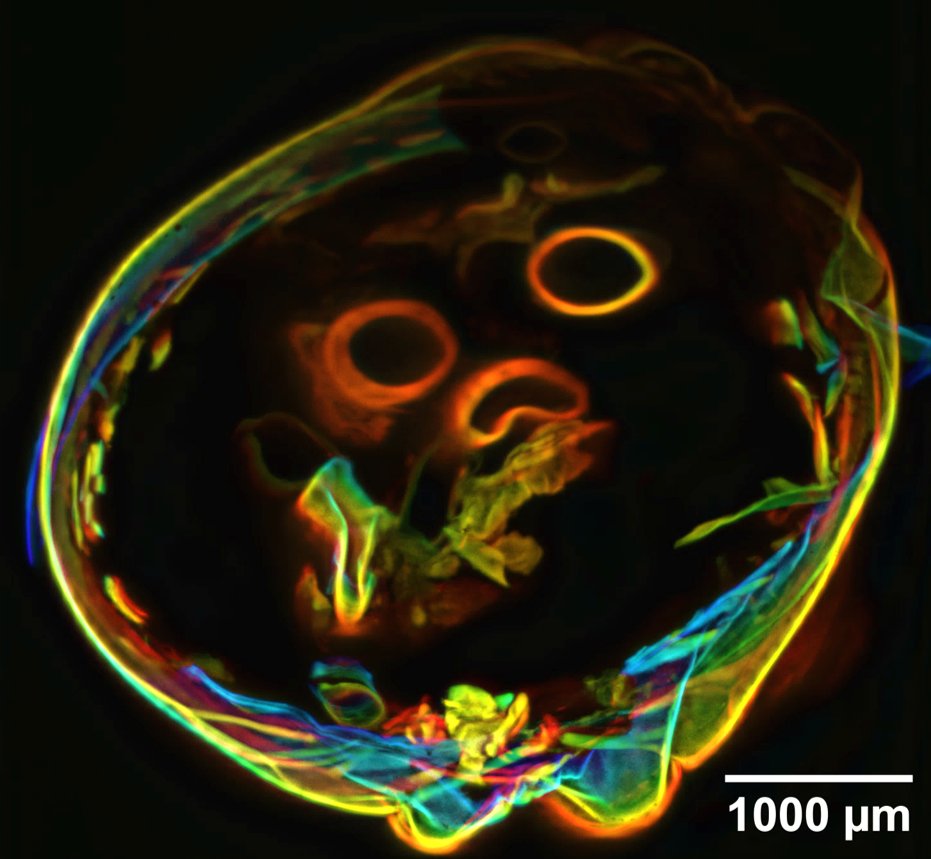 Scottish Microscopy Society (@scotmicro) on Twitter photo Finally, Congratulations to our image competition winner <a href="/lmr_1994/">Dr Liam Rooney</a>! Well done Liam and thank you for Bob from <a href="/ScientificAlba/">albascientific.com</a> for sponsorship! We'll be uploading all the image competition entries to our website soon. #ScotMicro2024 Finally, Congratulations to our image competition winner <a href="/lmr_1994/">Dr Liam Rooney</a>! Well done Liam and thank you for Bob from <a href="/ScientificAlba/">albascientific.com</a> for sponsorship! We'll be uploading all the image competition entries to our website soon. #ScotMicro2024