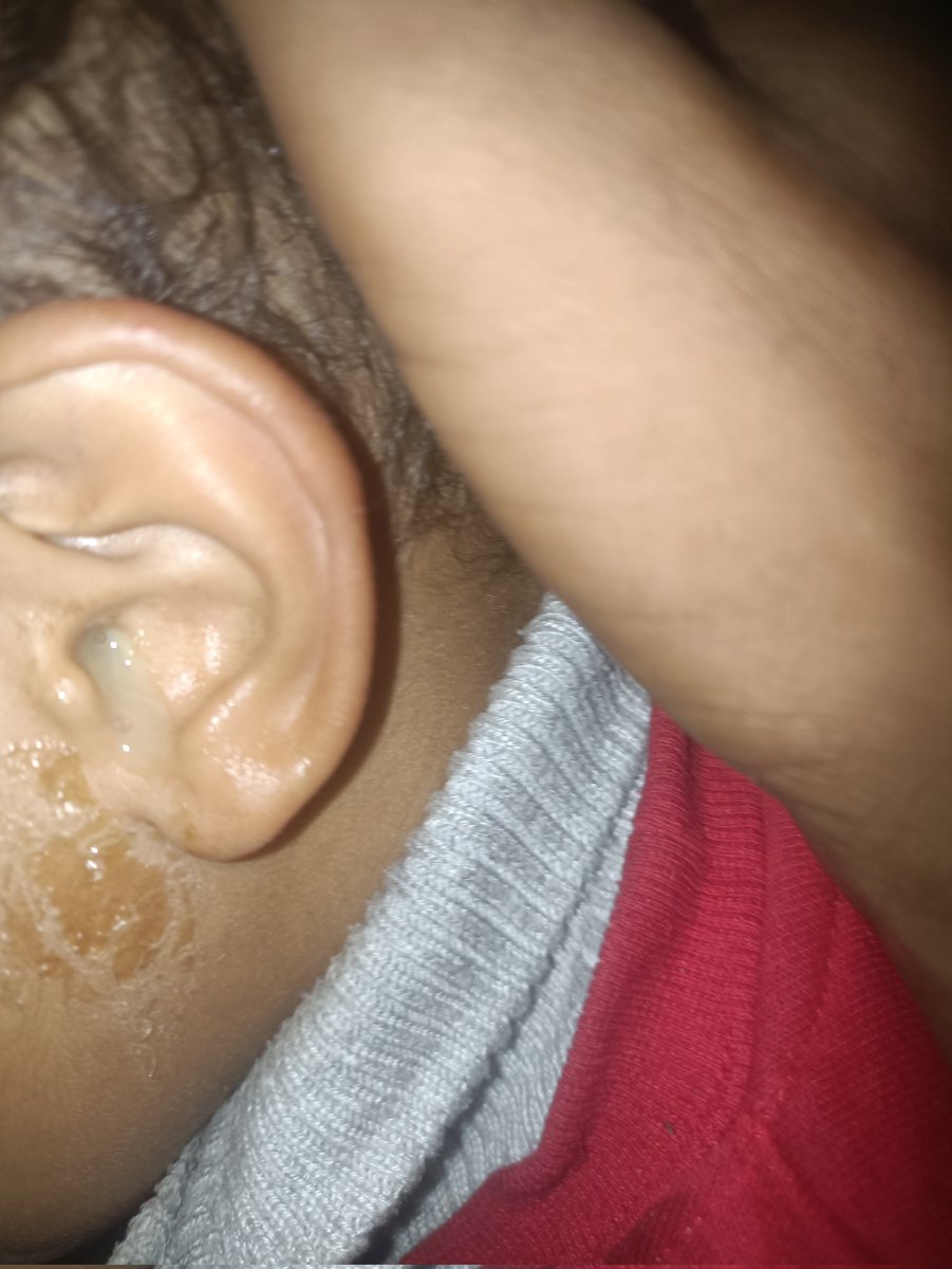 PLEASE DON'T SKIP ME :((
🚨My account has been restricted, 
So, my gfm doesn't appear to everyone! 
Please support my family gfm !!
by sharing and quoting and donating 💔🙏🏻
Please, Leave a comment 🇵🇸 or RT 🍉
gofund.me/db6b7feb