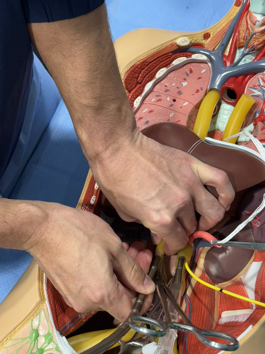 We completed our inaugural course on Donor Care Unit (DCU) Development focusing on #DCD management and #NRP. 13 successful DCD transfers to the DCU so far in 2024.
Special mention to our amazing Critical Care team and OPO partners who have made these innovations possible. Also