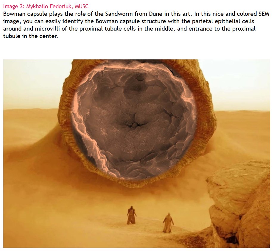 Despite life's challenges and the demands of work, the great people of my lab always light up the day with their incredible sense of humor! :) more details and images at 
ow.ly/5OlT50Uk8uC