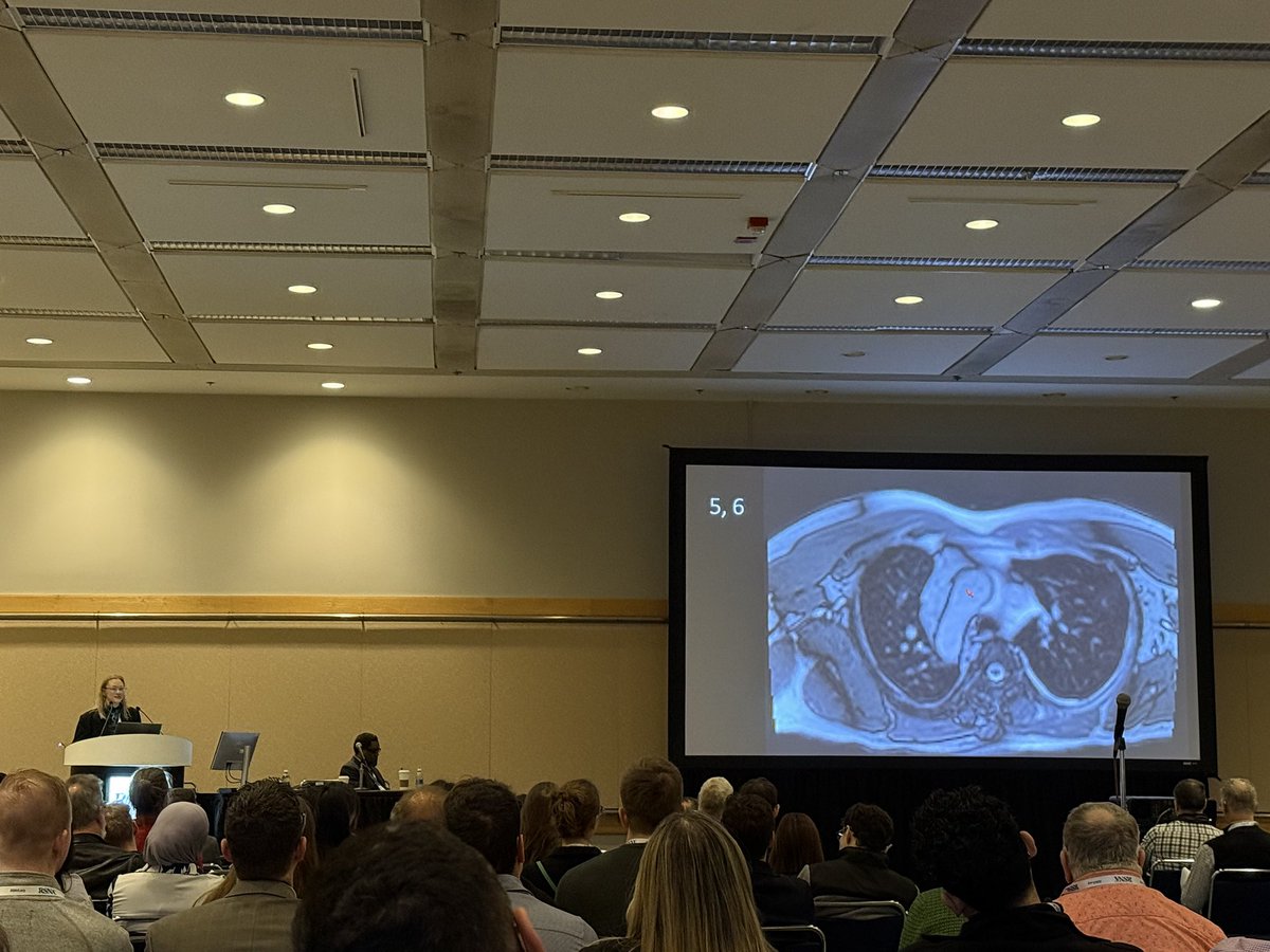 Lauren Kriger Groner (@laurengroner) on Twitter photo Great collection of #Cardiac Rapid Fire cases with <a href="/jjeudymd/">jjeudymd</a> <a href="/JordiBroncano/">Jordi Broncano</a> <a href="/LiisaBergmann/">Liisa Bergmann, MD, MBA</a>🫀😍 #RSNA24 Great collection of #Cardiac Rapid Fire cases with <a href="/jjeudymd/">jjeudymd</a> <a href="/JordiBroncano/">Jordi Broncano</a> <a href="/LiisaBergmann/">Liisa Bergmann, MD, MBA</a>🫀😍 #RSNA24