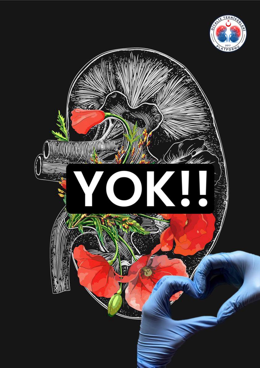 Sayın bakanım ne diyorsunuz bu duruma <a href="/drmemisoglu/">Prof. Dr. Kemal Memişoğlu</a> 
#DiyalizYönetmeliğiUnutuldu