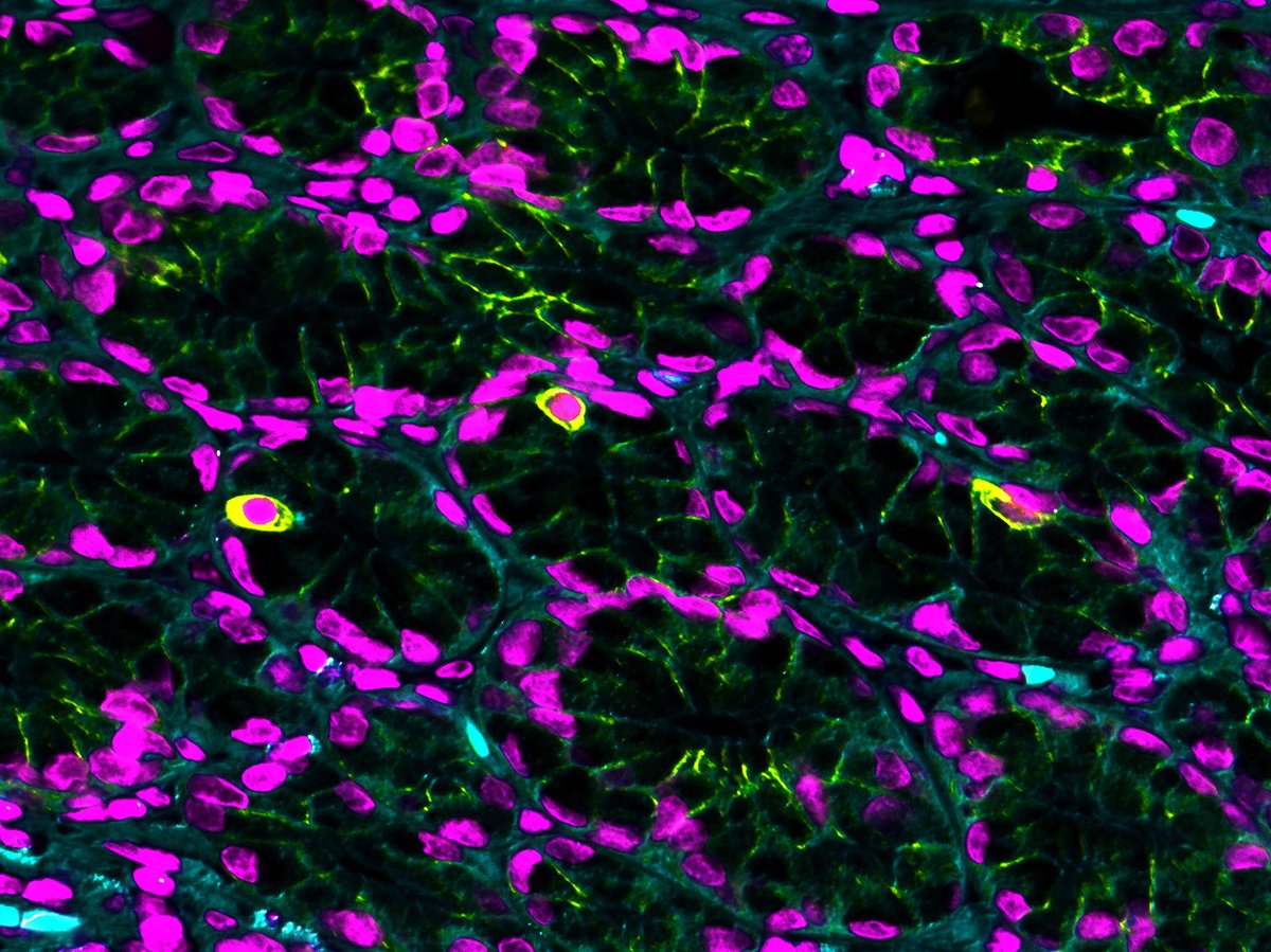 AmyEngevik's tweet image. Human gastric tuft cells in yellow for #TuftTuesday

#bioart #microscopy #histoart