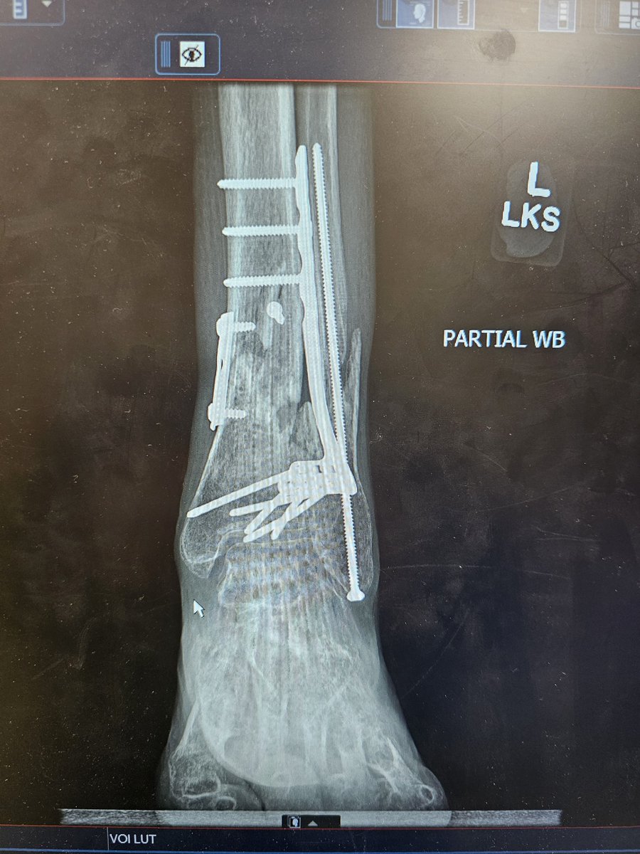 Today's xray been close to a year