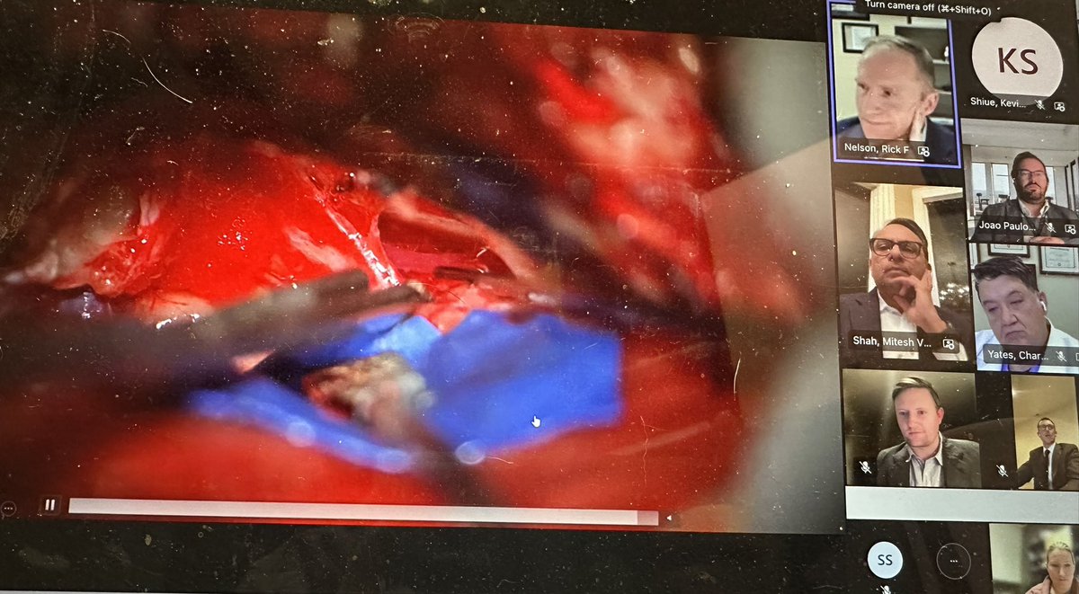 Great time tonight discussing #acousticNeuroma management at the 3rd annual #skullBase surgery course. <a href="/Neurosurgery_IU/">IU Neurosurgery</a> <a href="/joao_p_almeida/">Joao Paulo Almeida</a>