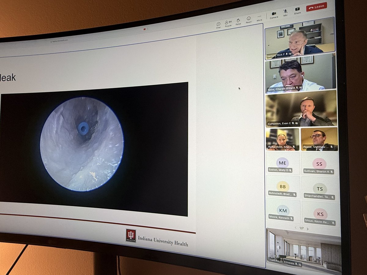 Indiana University Skull Base Symposium 
Great event tonight ( and second day coming up on Dec 11)

CSF leak / encephalocele session with <a href="/AngelaMRichard1/">Angela M Richardson, MD, PhD</a> <a href="/Neurosurgery_IU/">IU Neurosurgery</a> , Rick Nelson, Matt Pease, Charles Yates and team!

#skullbase <a href="/NASBSorg/">NASBS</a> <a href="/IUHealthFdn/">IU Health Foundation</a>