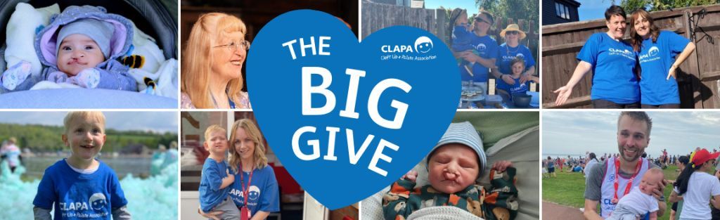 CRANE (@crane_news) on Twitter photo π CLAPA's big give campaign is coming up!
If you are able to give in December - please ensure it is between the 3rd and the 10th December as all funds will be matched in this time period.
buff.ly/4fJvy8c
LETS GIVE
#ChristmasChallenge
<a href="/CLAPACOMMUNITY/">Cleft Lip and Palate Association</a> π CLAPA's big give campaign is coming up!
If you are able to give in December - please ensure it is between the 3rd and the 10th December as all funds will be matched in this time period.
buff.ly/4fJvy8c
LETS GIVE
#ChristmasChallenge
<a href="/CLAPACOMMUNITY/">Cleft Lip and Palate Association</a>