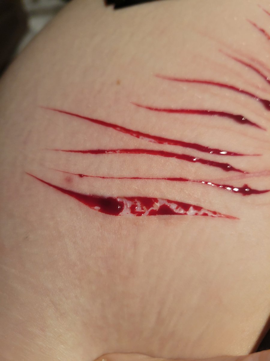 chainsawgutfvck's tweet photo. https://t.co/HbZdgvrnbQ