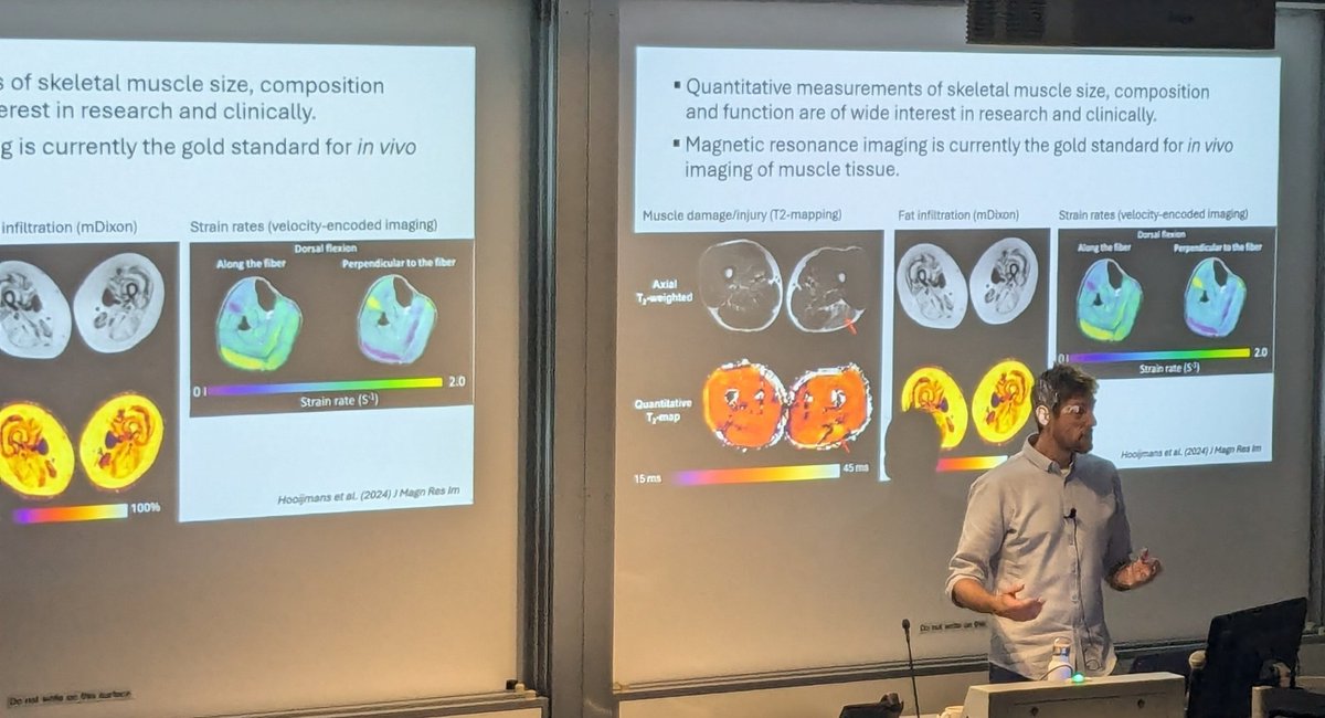 ANZSB (@anzsb) on Twitter photo The final keynote for #ABCANZORS2024 <a href="/bartbolsterlee/">Bart Bolsterlee</a> showcasing his amazing muscle imaging work 💪🏻
<a href="/ANZORS_/">ANZORS</a>
<a href="/neuraustralia/">NeuRA (Neuroscience Research Australia)</a> The final keynote for #ABCANZORS2024 <a href="/bartbolsterlee/">Bart Bolsterlee</a> showcasing his amazing muscle imaging work 💪🏻
<a href="/ANZORS_/">ANZORS</a>
<a href="/neuraustralia/">NeuRA (Neuroscience Research Australia)</a>
