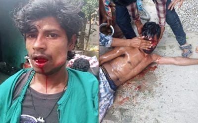 Birendra Ram, a Dalit from Bihar, faced unimaginable torment for standing firm in his religious beliefs

His refusal to destroy a Shiva Linga at the behest of a fanatical group led to violence, leaving his brother Guddu with a broken jaw and the family in financial ruin 💔

Sewa