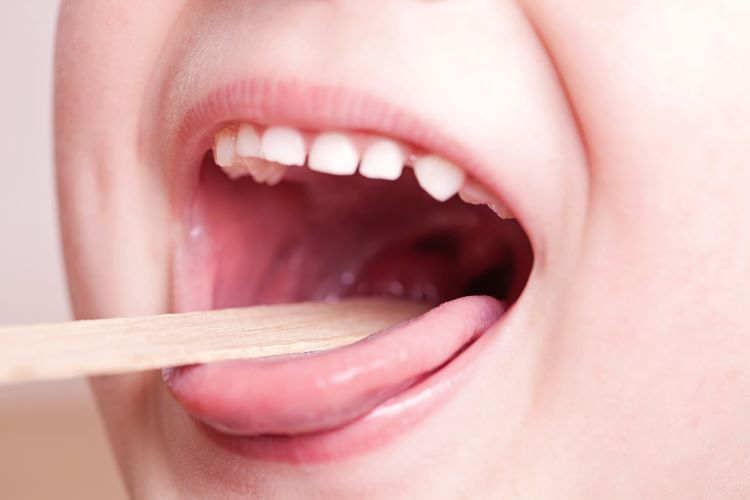 AboutKidsHealth's tweet image. Tonsillitis can cause a child to have a sore throat. When tonsils are doing their job of fighting viruses and bacteria, they increase in size, become inflamed and red, and can feel painful.
How to help with sore throat caused by #tonsillitis: ow.ly/GsM050Ubpew #SoreThroat
