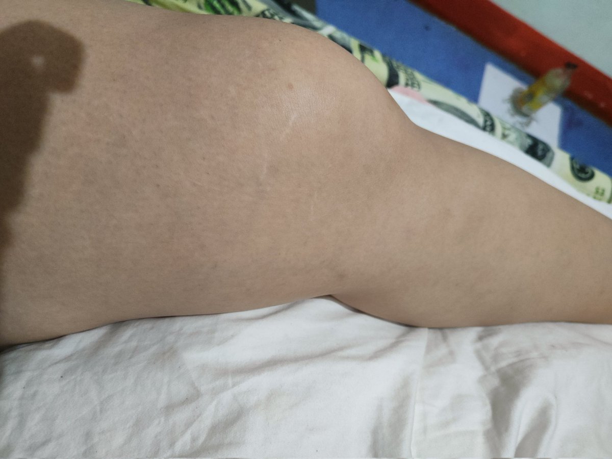 jhamhae_'s tweet photo. Crippled and living totally alone with the chance of flooding in the next 4 days. Damn. https://t.co/SOe60OuB2u