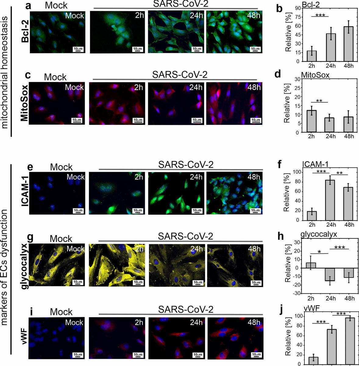 This may contribute to a better understanding of the development of vascular complications in COVID-19 as well as the discovery of new directions of therapy.  11/11

nature.com/articles/s4159…