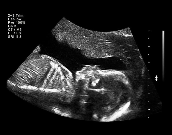 ScholarshipfPhd's tweet photo. Me in 1997 wasting time resting instead of writing my thesis https://t.co/MTIC6haB9z