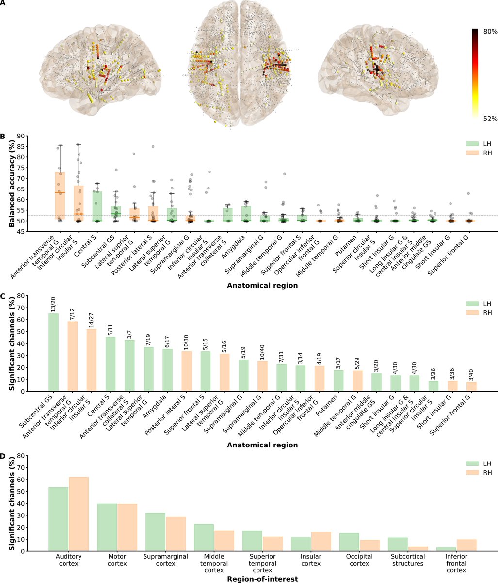 MaximeVerwoert's tweet photo. The most accurate and consistent results come from bilateral auditory regions, followed by motor regions ((sub)central sulcus), the supramarginal cortex and parts of the insula. These results highlight the potential of reaching the sulcal depth for speech neuroprostheses! 5/6 https://t.co/L6SFJgfweQ