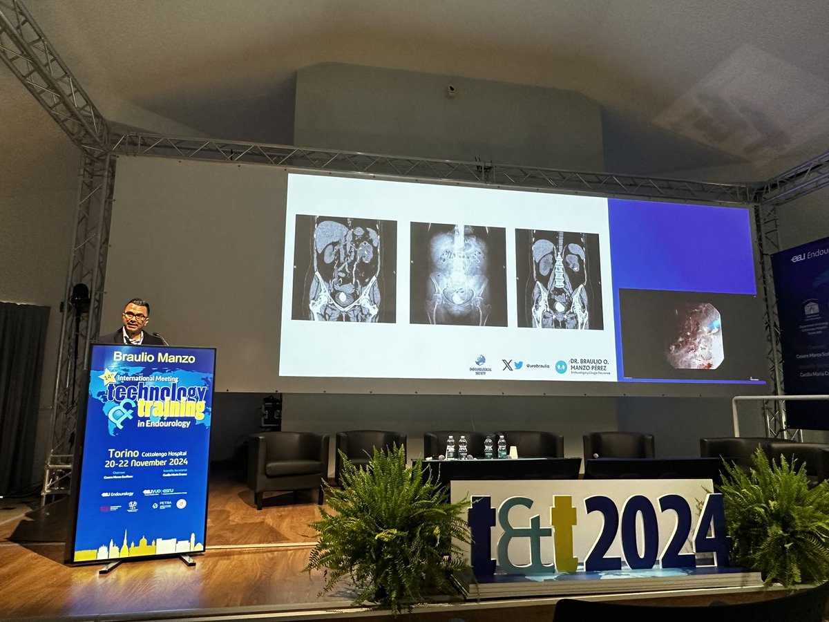 Great international high academic event!! 👏🏻 
<a href="/CAU_URO/">Confederación Americana de Urología (CAU)</a> 
@<a href="/smumexico/">SMU México</a> 
<a href="/young_endosoc/">Young Endo Society</a> 
<a href="/EAUYAUrology/">EAU Young Academics</a> <a href="/EAU_YAUroTech/">EAU Young Academics Urologist. Uro-Tech group</a>