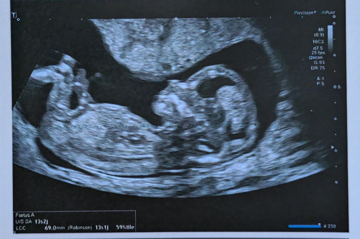 Auguste 🌵 tweet media