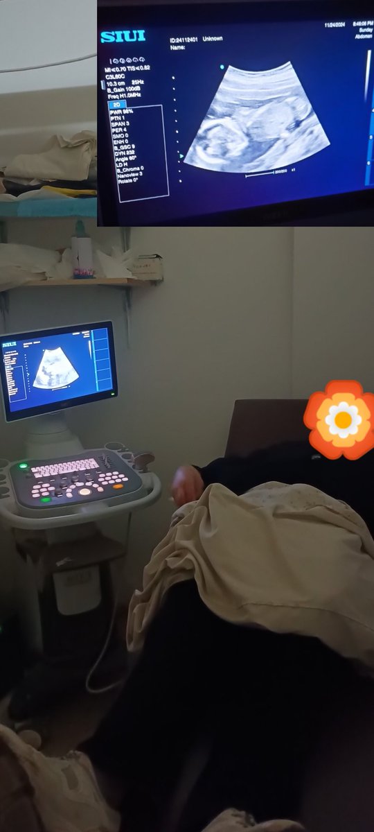 Hello everyone, please help me, my wife is due to give birth on December 16, I want to buy birth supplies and rent a room and stay away from the tent, I need you
My link in bio 🍉💔🙏